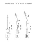 Tuned RF energy for selective treatment of atheroma and other target tissues and/or structures diagram and image