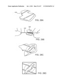 Tuned RF energy for selective treatment of atheroma and other target tissues and/or structures diagram and image