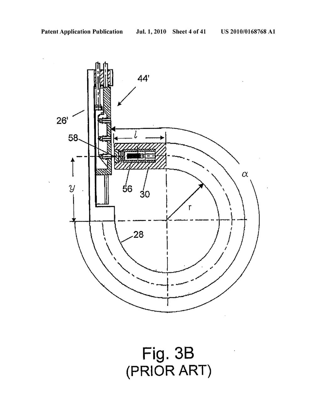 Devices and Methods for Treating Morbid Obesity - diagram, schematic, and image 05