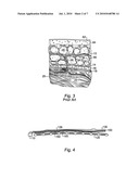 BIOLOGICAL TISSUE GROWTH THROUGH INDUCED TENSILE STRESS diagram and image