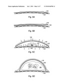 BIOLOGICAL TISSUE GROWTH THROUGH INDUCED TENSILE STRESS diagram and image