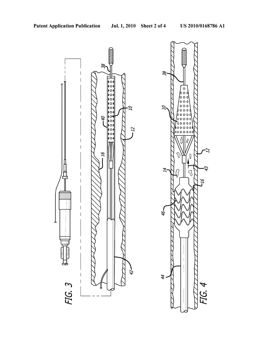 SUPPORT FRAME FOR AN EMBOLIC PROTECTION DEVICE - diagram, schematic, and image 03