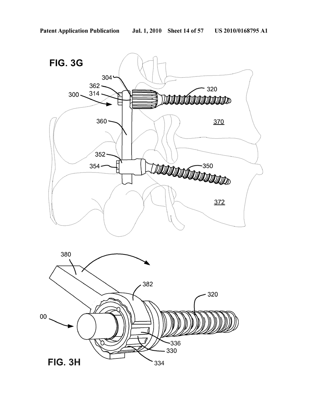 LOAD-SHARING BONE ANCHOR HAVING A NATURAL CENTER OF ROTATION AND METHOD FOR DYNAMIC STABILIZATION OF THE SPINE - diagram, schematic, and image 15