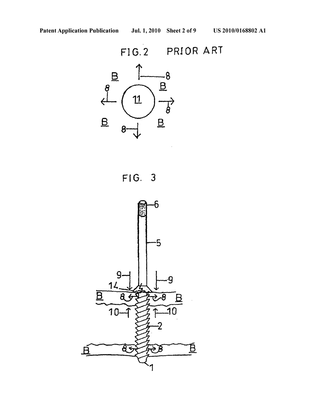 Renew compression screw - diagram, schematic, and image 03
