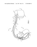 METHOD AND SYSTEM FOR DETECTING CARDIAC ARRHYTHMIAS DURING OVERDRIVE PACING diagram and image