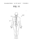 AUTOMATIC THRESHOLD ASSESMENT UTILIZING PATIENT FEEDBACK diagram and image