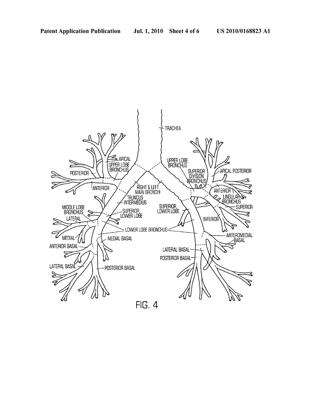 METHOD AND APPARATUS FOR THE TREATMENT OF RESPIRATORY AND OTHER INFECTIONS USING ULTRAVIOLET GERMICIDAL IRRADIATION - diagram, schematic, and image 05