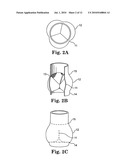 METHODS AND SYSTEMS FOR REDUCING PARAVALVULAR LEAKAGE IN HEART VALVES diagram and image