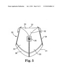 METHODS AND SYSTEMS FOR REDUCING PARAVALVULAR LEAKAGE IN HEART VALVES diagram and image