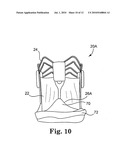 METHODS AND SYSTEMS FOR REDUCING PARAVALVULAR LEAKAGE IN HEART VALVES diagram and image