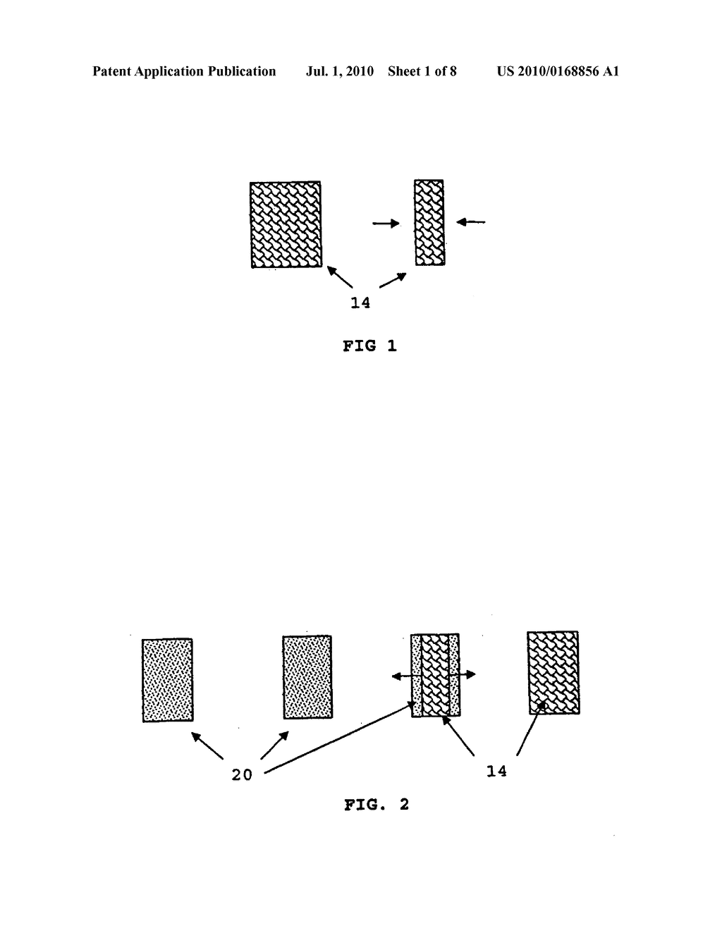 Multiple piece tissue void filler - diagram, schematic, and image 02