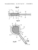 Intervertebral Disc Prosthesis diagram and image