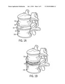 ORTHOPEDIC IMPLANT WITH FLEXIBLE KEEL diagram and image