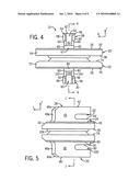 ORTHOPEDIC IMPLANT WITH FLEXIBLE KEEL diagram and image