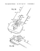 ORTHOPEDIC IMPLANT WITH FLEXIBLE KEEL diagram and image