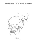 ARTIFICIAL DURA BIOMEDICAL DEVICE AND BRAIN SURGERY METHOD UTILIZING THE SAME diagram and image