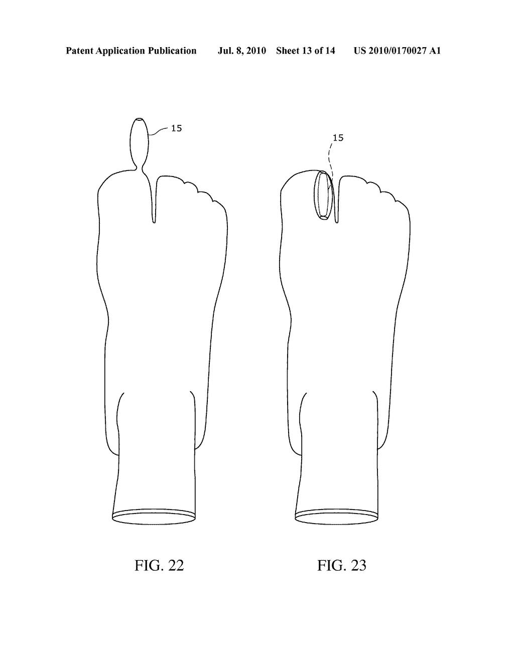 Toe Spacer Sock and Corrective Footwear - diagram, schematic, and image 14