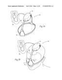 Self-contained, intermittent positive airway pressure systems and methods for treating sleep apnea, snoring, and other respiratory disorders diagram and image