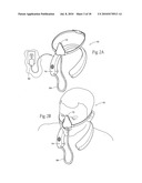 Self-contained, intermittent positive airway pressure systems and methods for treating sleep apnea, snoring, and other respiratory disorders diagram and image