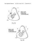 Self-contained, intermittent positive airway pressure systems and methods for treating sleep apnea, snoring, and other respiratory disorders diagram and image