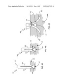 METHOD AND APPARATUS FOR DEPLOYING A SHAPE MEMORY POLYMER diagram and image