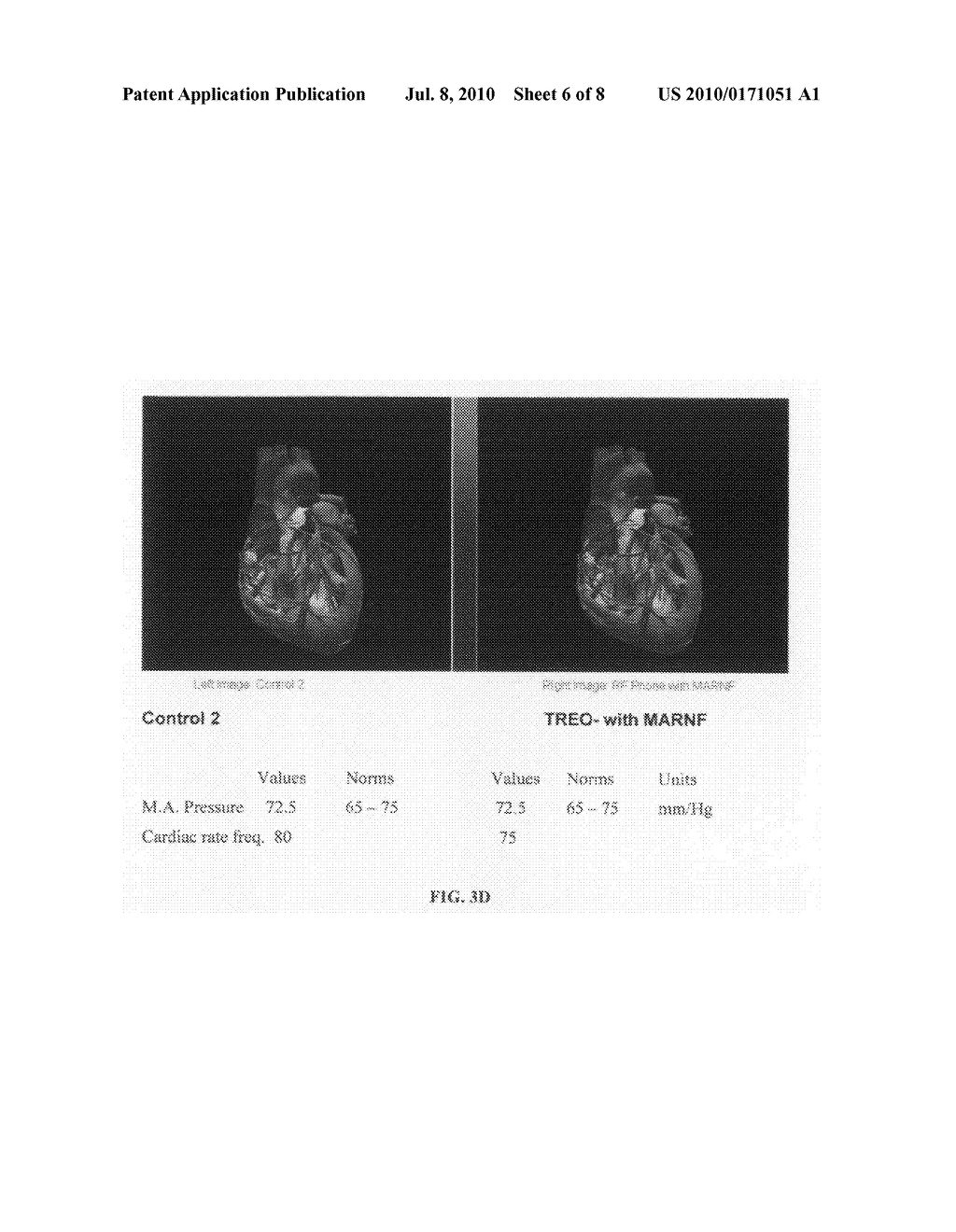 Devices and methods for protection against exposure to electromagnetic radiation - diagram, schematic, and image 07