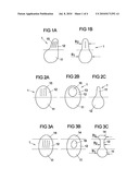 Airbag for a vehicle occupant restraint system and a method for protecting a vehicle occupant diagram and image