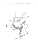 BRACKET SYSTEM ADAPTED FOR USE IN A RAISING AND LOWERING MECHANISM OF AN ADJUSTABLE HEADREST OF A VEHICLE SEAT diagram and image