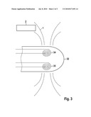 DEGRADATION AND INTEGRITY MEASURING DEVICE FOR ABSORBABLE METAL IMPLANTS diagram and image