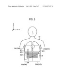 MAGNETIC RESONANCE IMAGING APPARATUS diagram and image