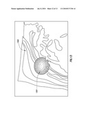 VISUALIZING REGION GROWING IN THREE DIMENSIONAL VOXEL VOLUMES diagram and image