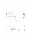 LASER PROJECTION DEVICE AND METHOD FOR MANUFACTURING A LASER PROJECTION DEVICE diagram and image