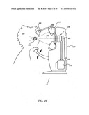 OCULAR RADIOSURGERY diagram and image