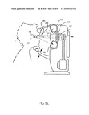 OCULAR RADIOSURGERY diagram and image