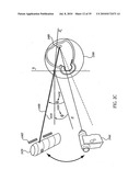 OCULAR RADIOSURGERY diagram and image