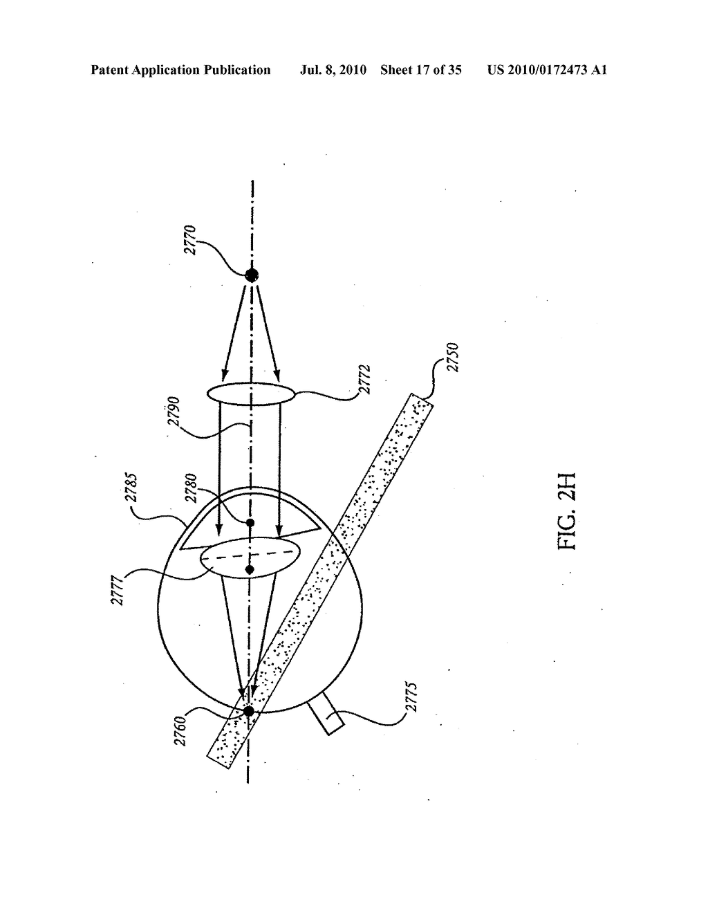 OCULAR RADIOSURGERY - diagram, schematic, and image 18