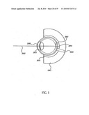 OCULAR RADIOSURGERY diagram and image