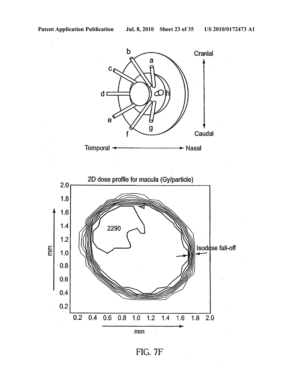 OCULAR RADIOSURGERY - diagram, schematic, and image 24