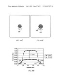 OCULAR RADIOSURGERY diagram and image