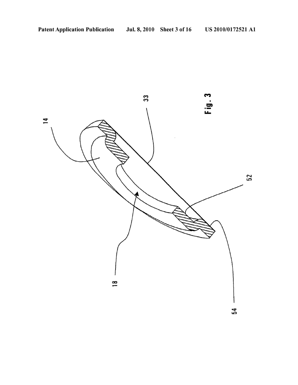 Electret Assembly For A Microphone Having A Backplate With Improved Charge Stability - diagram, schematic, and image 04