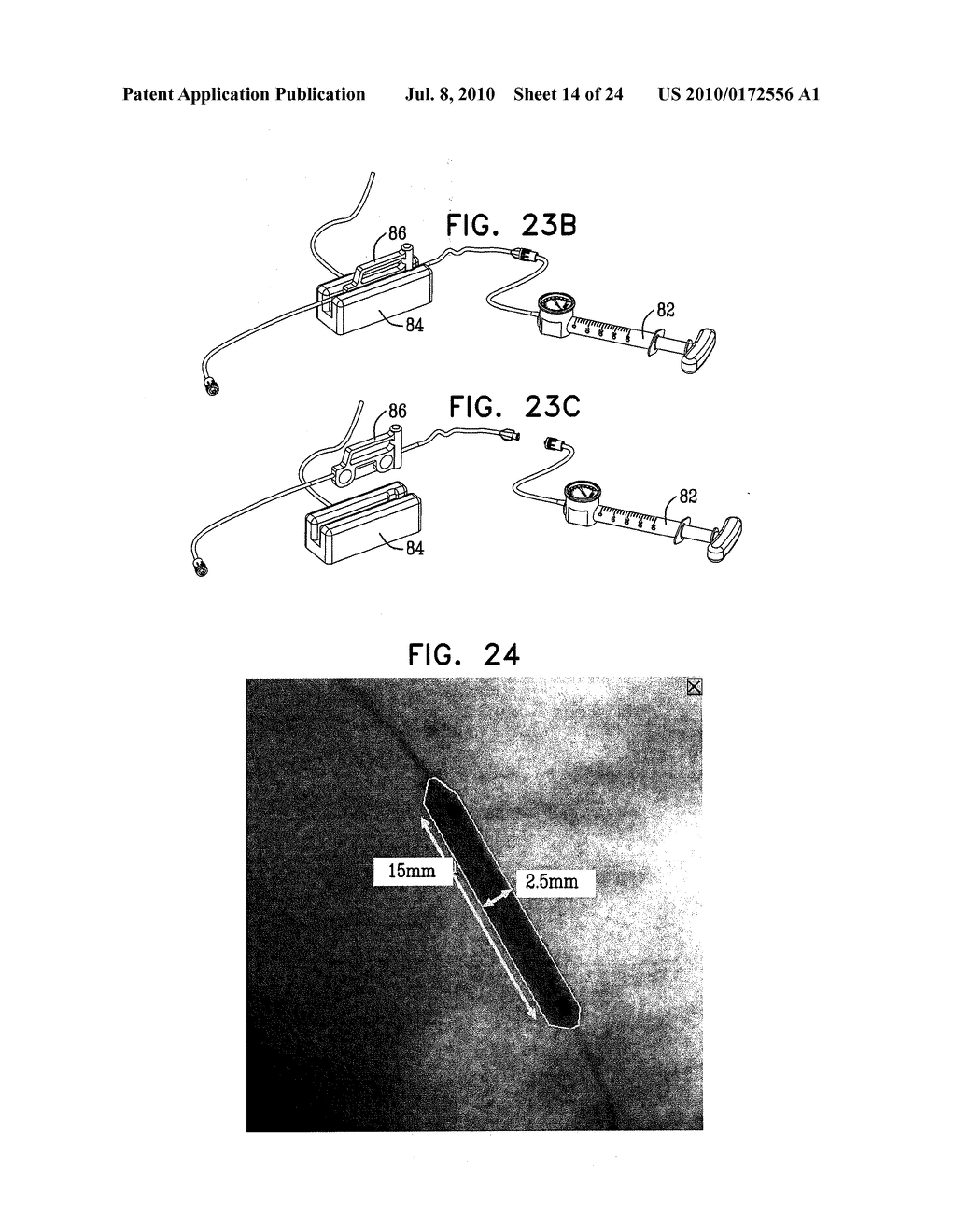 AUTOMATIC ENHANCEMENT OF AN IMAGE STREAM OF A MOVING ORGAN - diagram, schematic, and image 15