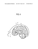 MEDIAN PLANE DETERMINATION APPARATUS AND MAGNETIC RESONANCE IMAGING SYSTEM diagram and image