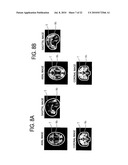 MEDIAN PLANE DETERMINATION APPARATUS AND MAGNETIC RESONANCE IMAGING SYSTEM diagram and image