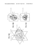 MEDIAN PLANE DETERMINATION APPARATUS AND MAGNETIC RESONANCE IMAGING SYSTEM diagram and image