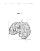 MEDIAN PLANE DETERMINATION APPARATUS AND MAGNETIC RESONANCE IMAGING SYSTEM diagram and image