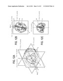 MEDIAN PLANE DETERMINATION APPARATUS AND MAGNETIC RESONANCE IMAGING SYSTEM diagram and image