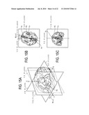 MEDIAN PLANE DETERMINATION APPARATUS AND MAGNETIC RESONANCE IMAGING SYSTEM diagram and image