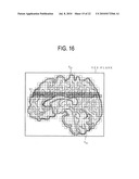 MEDIAN PLANE DETERMINATION APPARATUS AND MAGNETIC RESONANCE IMAGING SYSTEM diagram and image