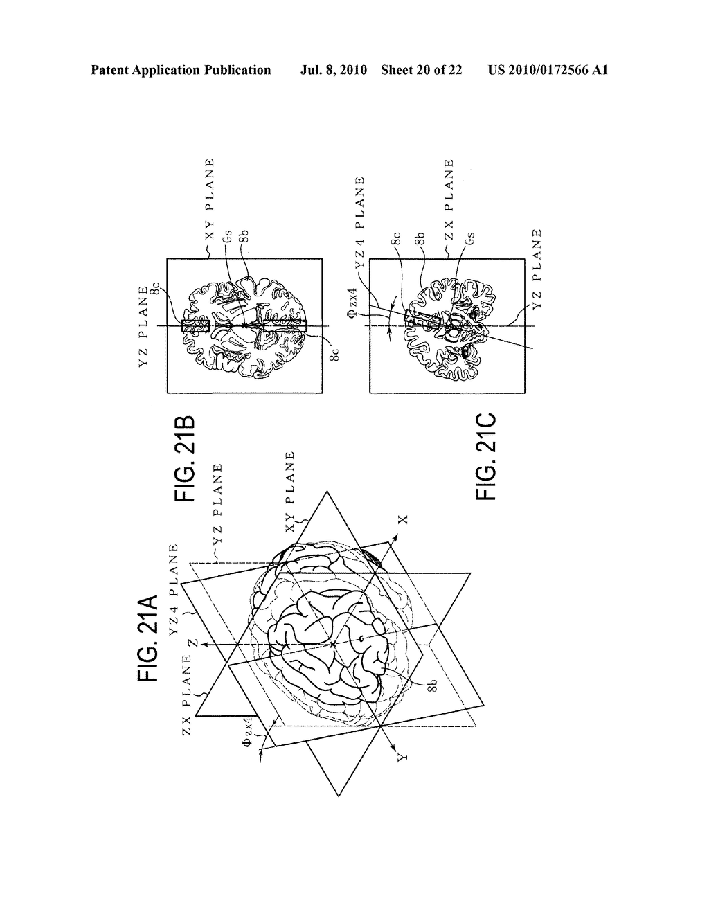 MEDIAN PLANE DETERMINATION APPARATUS AND MAGNETIC RESONANCE IMAGING SYSTEM - diagram, schematic, and image 21