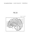 MEDIAN PLANE DETERMINATION APPARATUS AND MAGNETIC RESONANCE IMAGING SYSTEM diagram and image